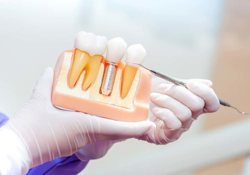 Understanding Endosteal Implants for Effective Dental Implant Treatment