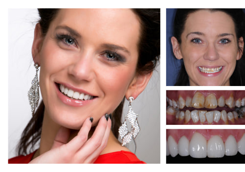 The Impact of Before and After Photos in Cosmetic Dentistry